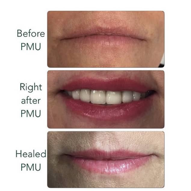 PMU Before and After Endless Beauty Services