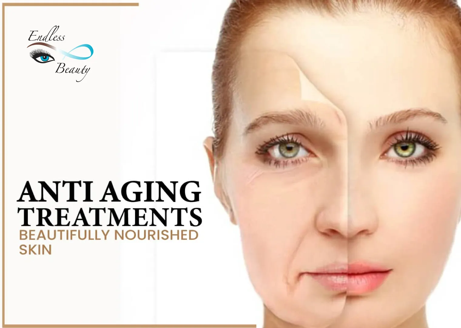 My Endless Beauty - Anti Aging Treatments